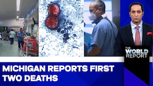Cyclospora Outbreak: Diarrhea-Causing Parasite Wreaks Havoc in America | Michigan