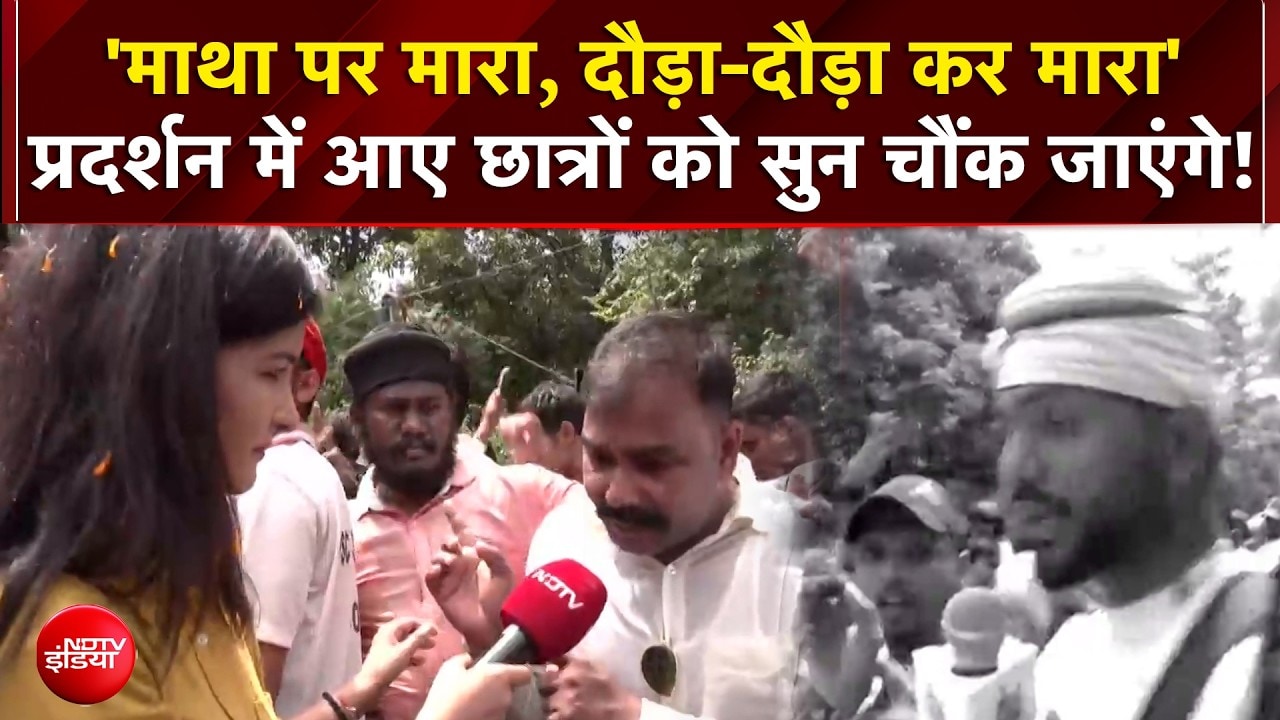 JPSC प्रोटेस्‍ट: 'माथा पर मारा, दौड़ा-दौड़ा कर पीटा', पुलिस की बर्बरता छात्रों की जुबानी