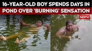 Bengal Teen Stays In Ponds, Says He Feels 'Burning Sensation' Outside Water