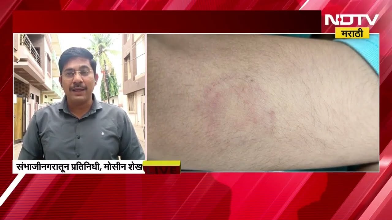Ch. Sambhajinagar 5 वर्षांच्या चिमुरड्यावर वर्गात क्रूर अत्याचार जाब विचारणाऱ्या पालकाचा हातही मोडला