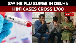 Swine Flu Surge In Delhi: H1N1 Cases Cross 1,700, Masks Advised In Crowded Spaces