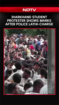 Jharkhand Protest | Protester Shows Lathi-Charge Marks After Police Action During March