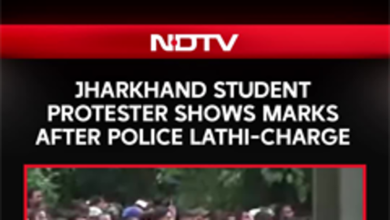 Protester Shows Lathi-Charge Marks After Police Action During March