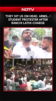 JSSC-JPSC Protest | 'They Hit Us On The Head, Arms': Aspirant Recounts Lathi-Charge In Ranchi