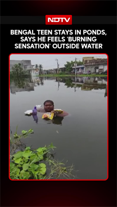 Bengal Teen Stays In Ponds, Says He Feels 'Burning Sensation' Outside Water