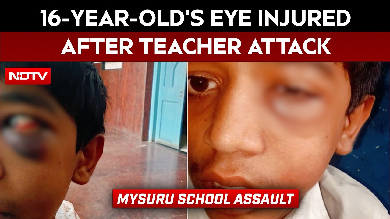 Mysuru School Assault: Teacher Booked For Allegedly Punching 16-Year-Old Student In Eye