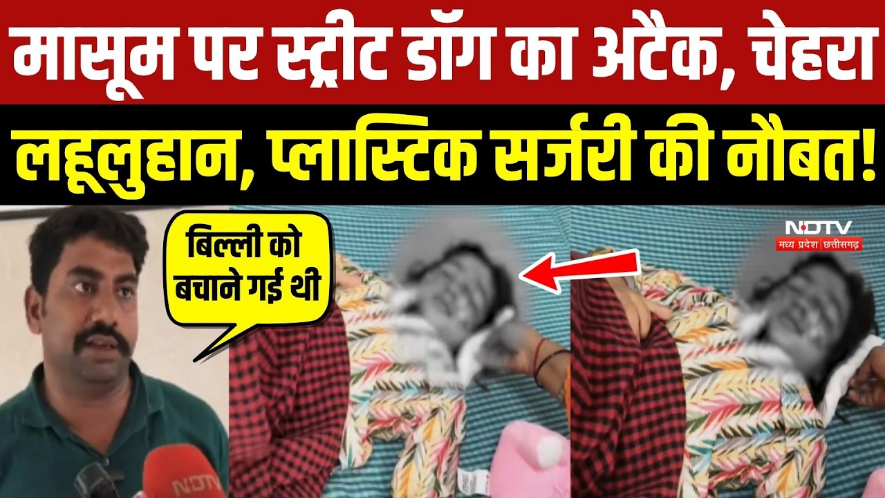 मासूम पर स्ट्रीट डॉग का अटैक, चेहरा लहूलुहान, प्लास्टिक सर्जरी की नौबत!