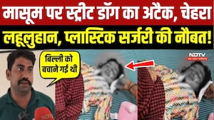 मासूम पर स्ट्रीट डॉग का अटैक, चेहरा लहूलुहान, प्लास्टिक सर्जरी की नौबत!
