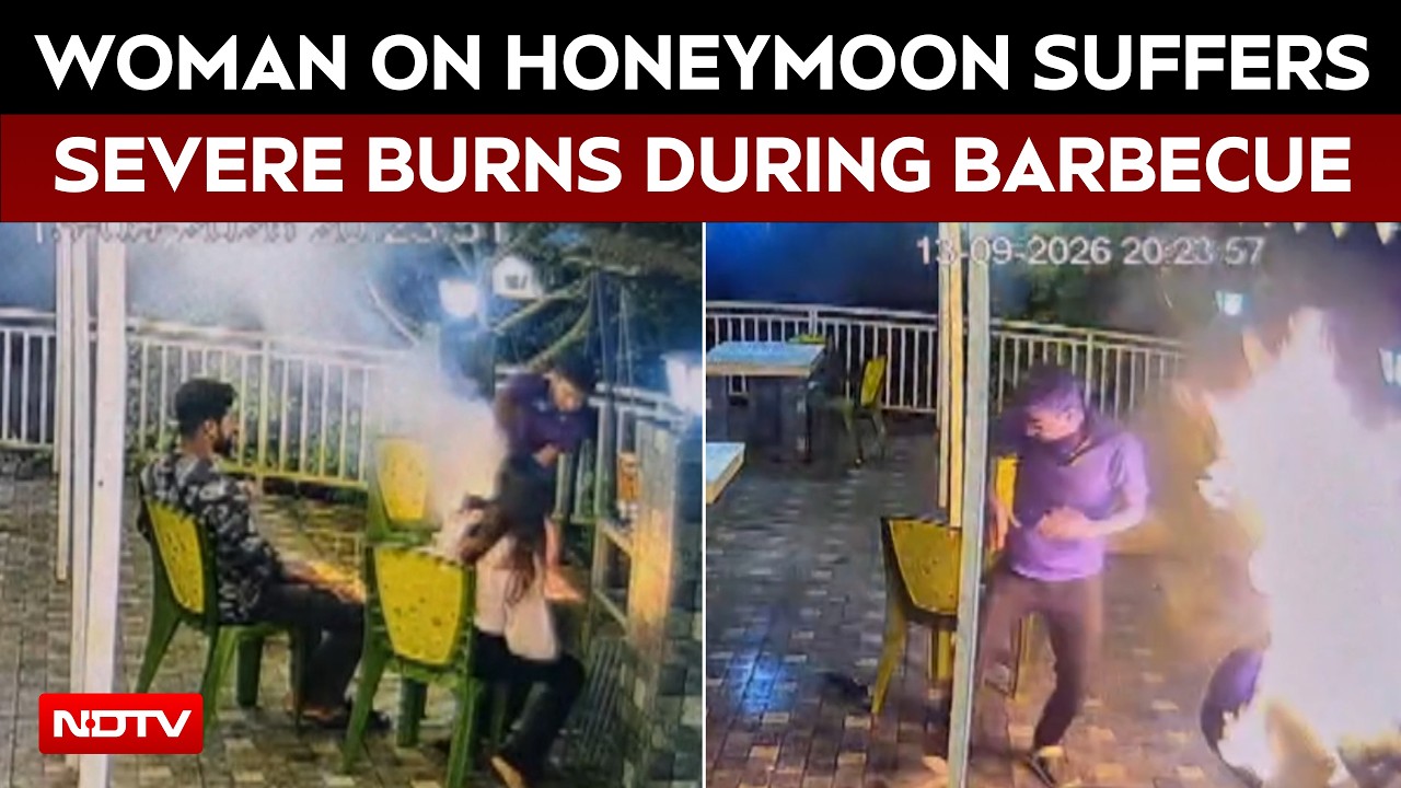 Woman On Honeymoon Suffers Severe Burns During Barbecue At Bengal Homestay