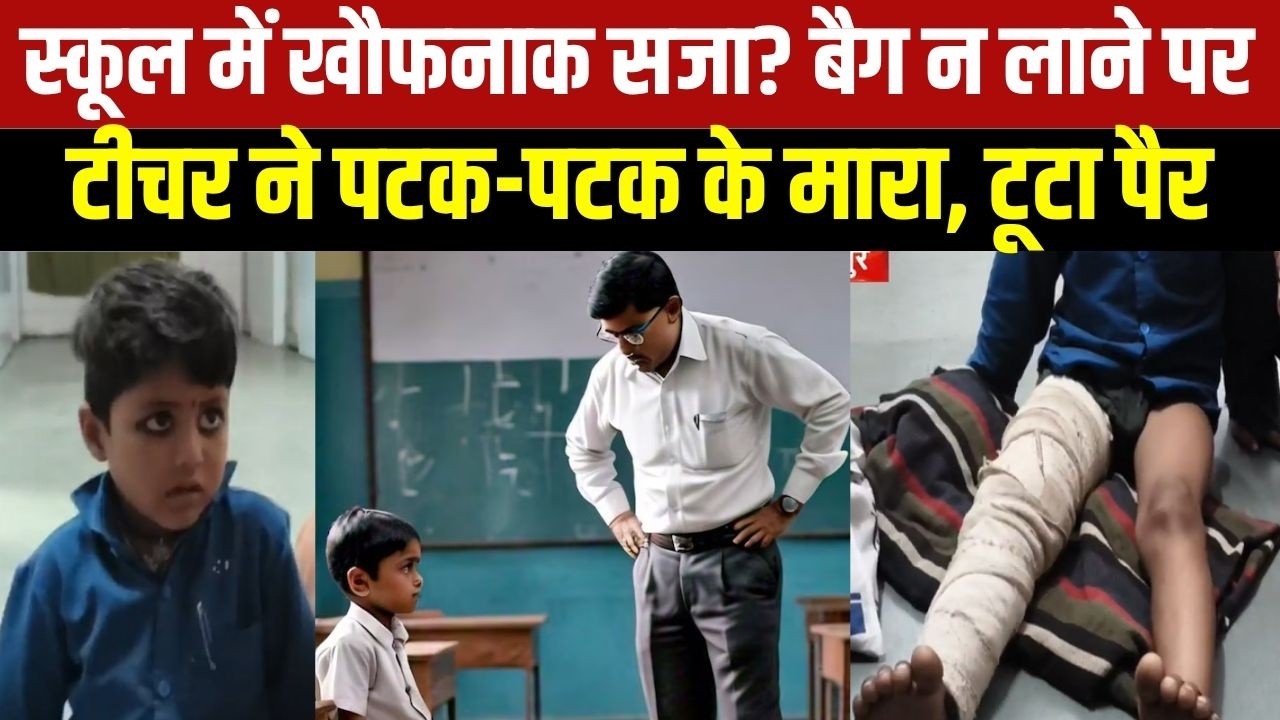 MP NEWS: Chhatarpur में 5 साल के बच्चे की पिटाई, Teacher पर जांघ की हड्डी तोड़ने का आरोप । TOP NEWS