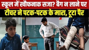 MP NEWS: Chhatarpur में 5 साल के बच्चे की पिटाई, Teacher पर जांघ की हड्डी तोड़ने का आरोप । TOP NEWS