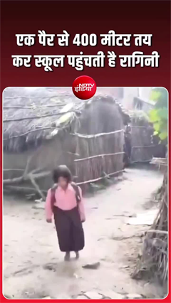 Video: 6 महीने की उम्र में खो दिया पैर, अब डॉक्टर बनने का सपना लेकर स्कूल जाती है रागिनी