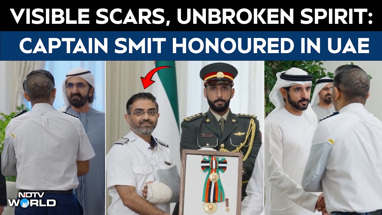Captain Smit Machchhar Appears With Visible Head Wounds During UAE President Meet | Flydubai Attack