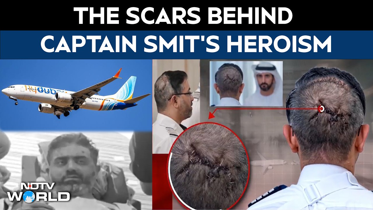 FlyDubai Cockpit Attack: The Injuries, Courage And Remarkable Recovery Of Captain Smit