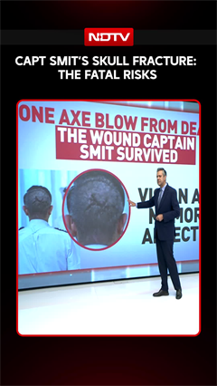 Captain Smit's Skull Fracture: The Fatal Risks