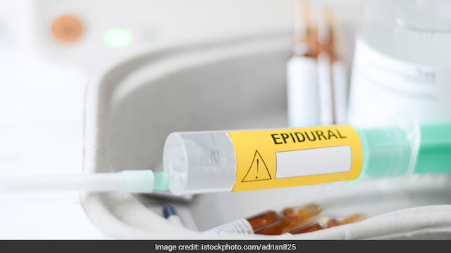 Epidural does not harm the baby and makes childbirth less painful for the mother