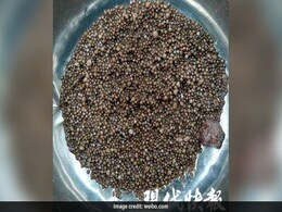 Woman Complained Of Back Pain, Doctors Found Almost 3,000 Kidney Stones Woman Complained Of Back Pain, Doctors Found Almost 3,000 Kidney Stones