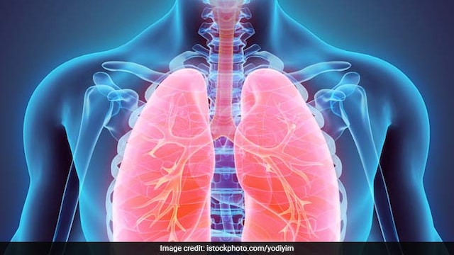 5 foods that will help you detoxify your lungs