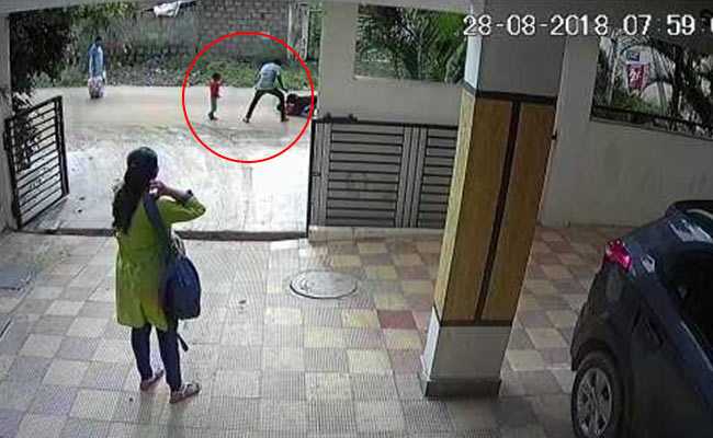 5-Year-Old Boy's Condition Serious After Dog Attacks Him In Hyderabad