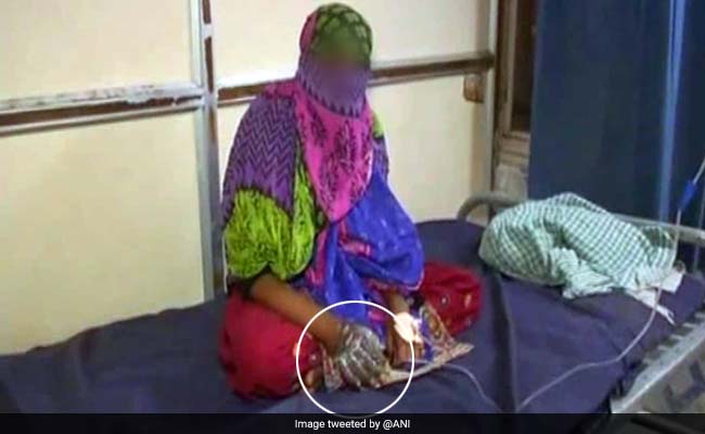 Gujarat Woman Forces 17-Year-Old Girl's Hand In Hot Oil Over Suspected Affair With Husband