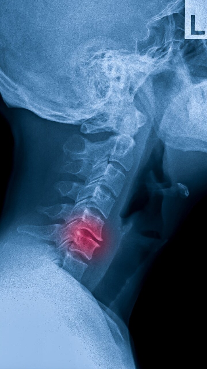 bone cancer symptoms