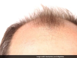 गंजी खोपड़ी पर भी उग सकते हैं नए बाल, बस शैंपू के साथ इस पानी को मिलाकर धोलें बाल, हर कोई पूछेगा राज गंजी खोपड़ी पर भी उग सकते हैं नए बाल, बस शैंपू के साथ इस पानी को मिलाकर धोलें बाल, हर कोई पूछेगा राज