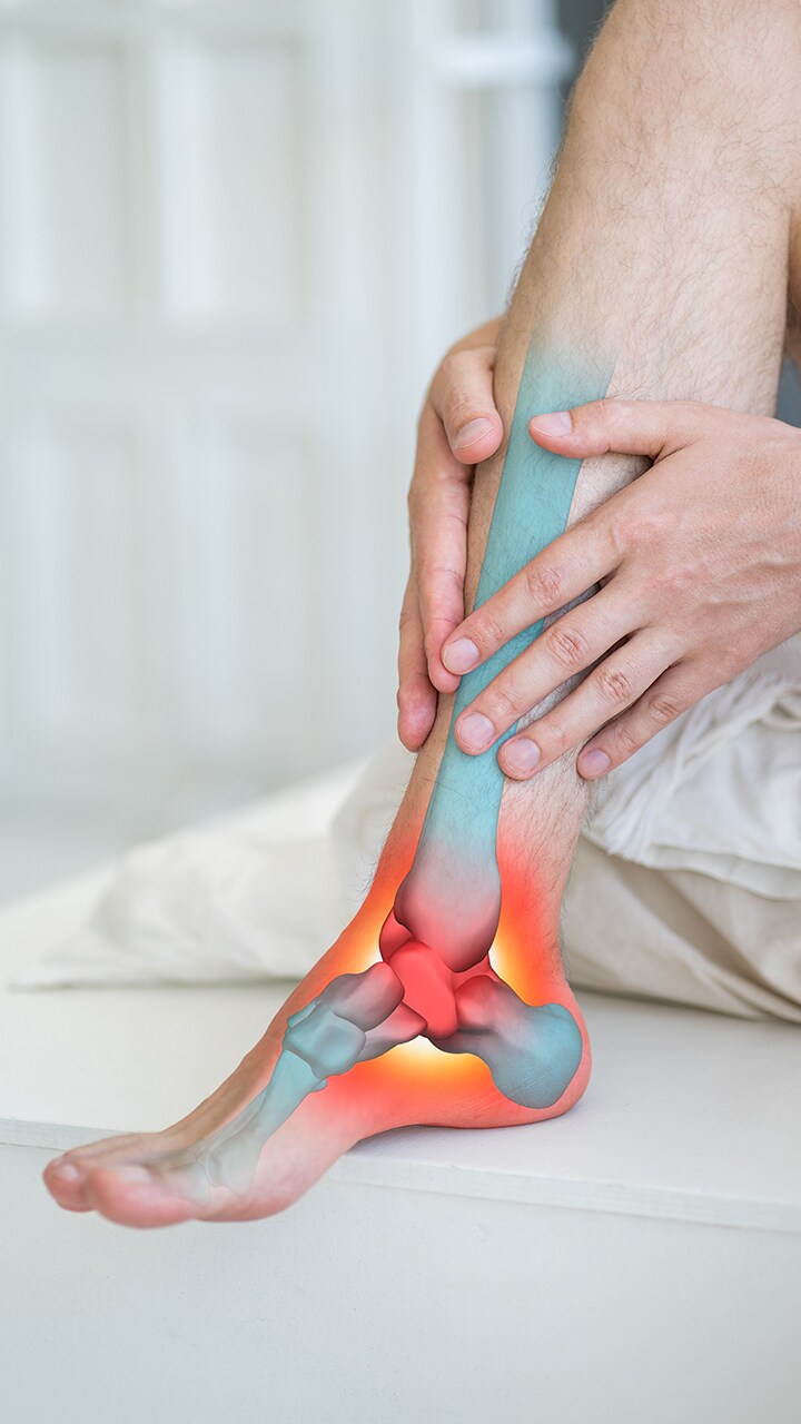leg pain