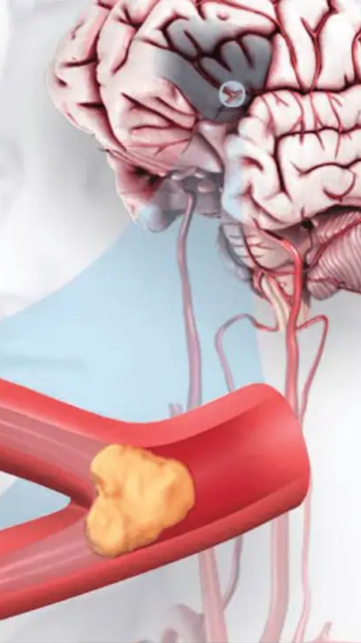 Deadliest Diseases In The World