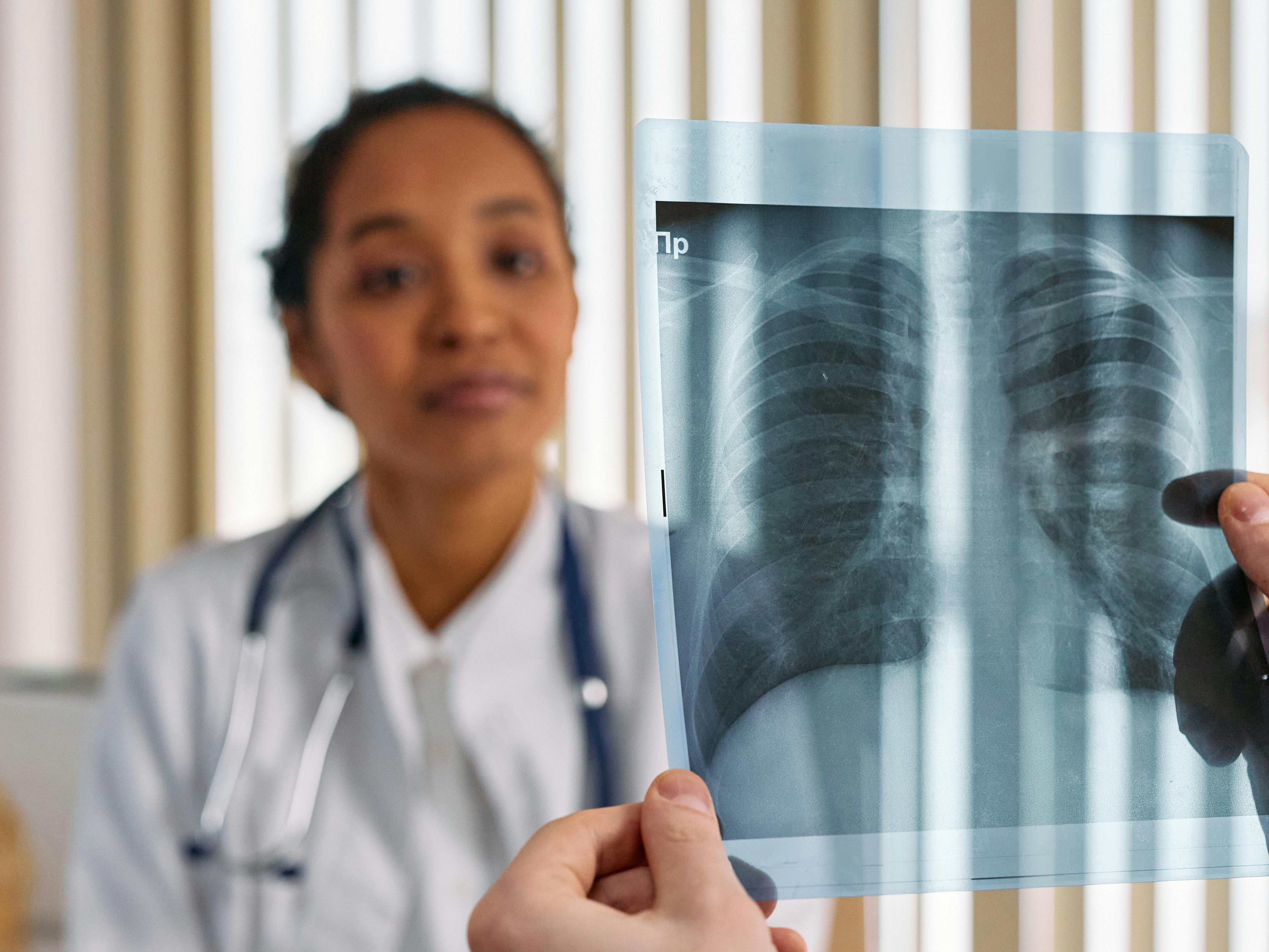 Tuberculosis Signs And Symptoms