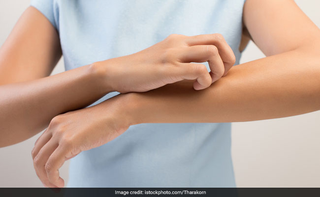 4 Natural Beauty Ingredients To Ease Skin Irritation And Itching