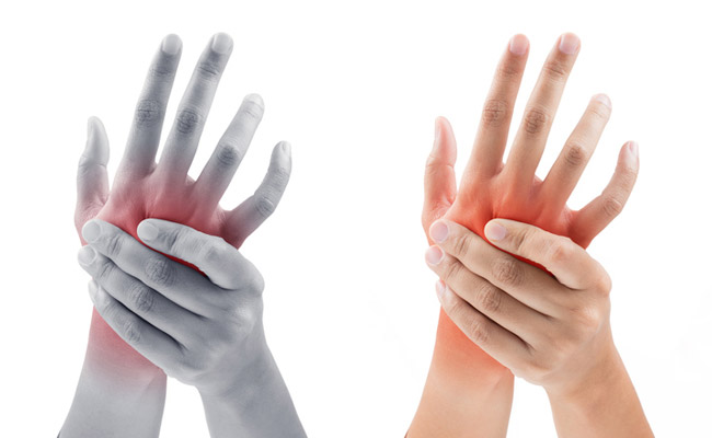 Anemia could be the reason you have cold hands
