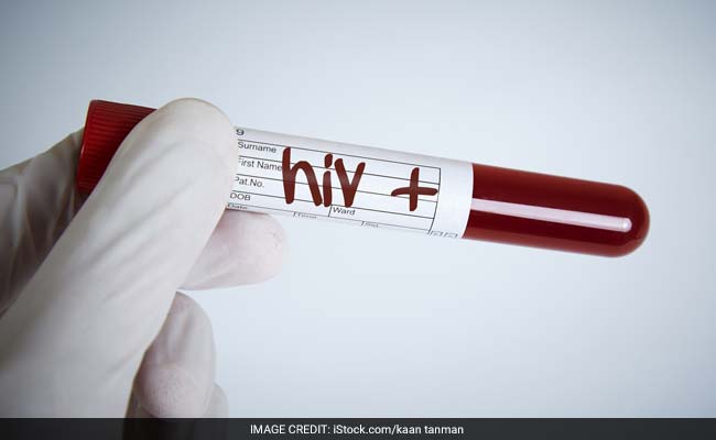 HIV+ Man With Cancer Cured Of Both After Stem Cell Therapy, Claims Study
