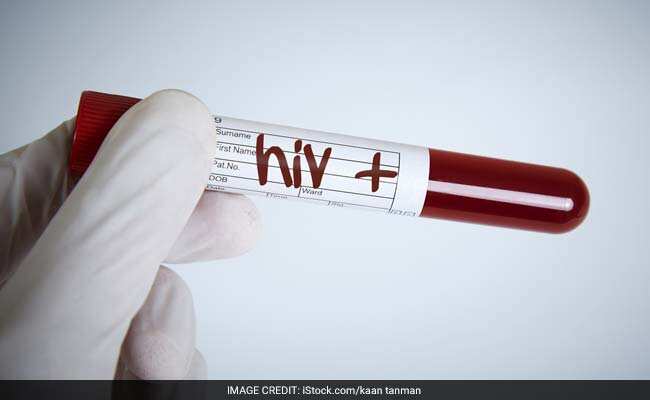 दिल की बीमारियों का खतरा दोगुना कर सकता है HIV Infection