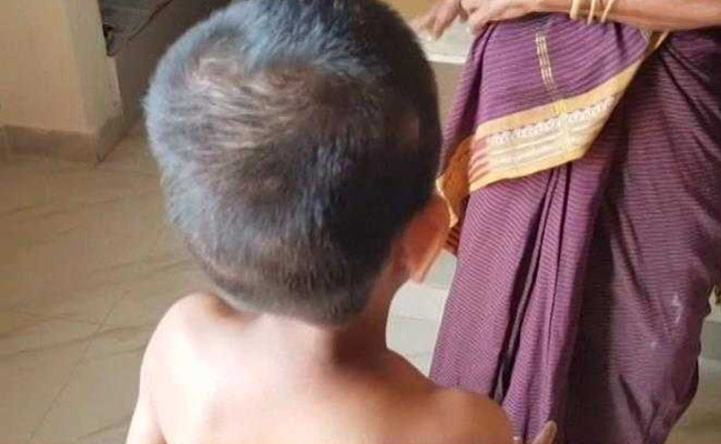 10-Year-Old Differently Abled Girl Allegedly Fed Soap At Hyderabad Home