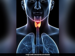 थायराइड की बीमारी को क्यों माना जाता है खतरनाक? जानें Thyroid आपके शरीर को कैसे बर्बाद कर सकता है थायराइड की बीमारी को क्यों माना जाता है खतरनाक? जानें Thyroid आपके शरीर को कैसे बर्बाद कर सकता है