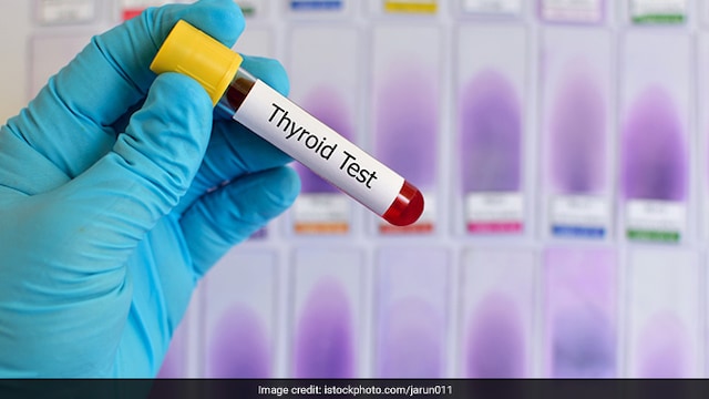 Hypothyroidism is a condition in which your body doesn't produce enough thyroid hormone