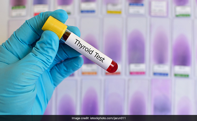 Hypothyroidism is a condition in which your body doesn't produce enough thyroid hormone