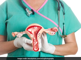 PCOS In Women Tied To Attention, Cognitive Issues: Study PCOS In Women Tied To Attention, Cognitive Issues: Study