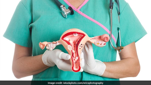 Early diagnosis can help treat the cancer on time