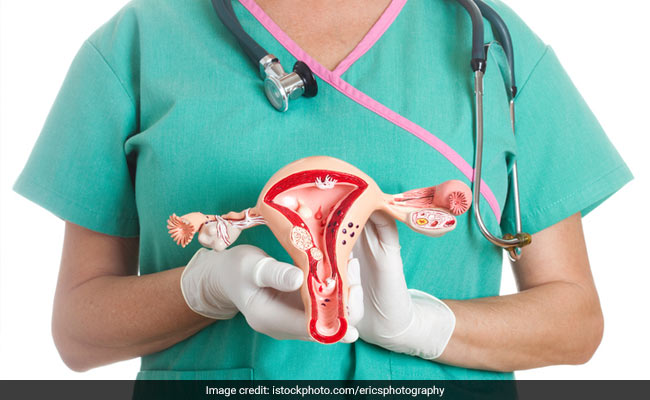 Do not miss these symptoms and pay visit to your gynecologist soon