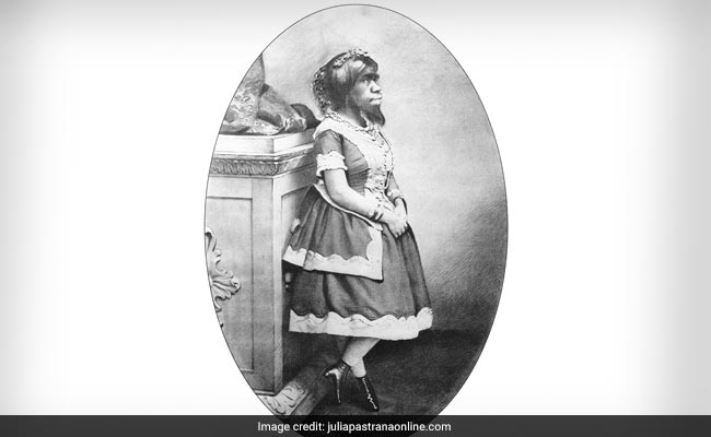 "The Bear Woman": The Brief, Sad Life Of Julia Pastrana