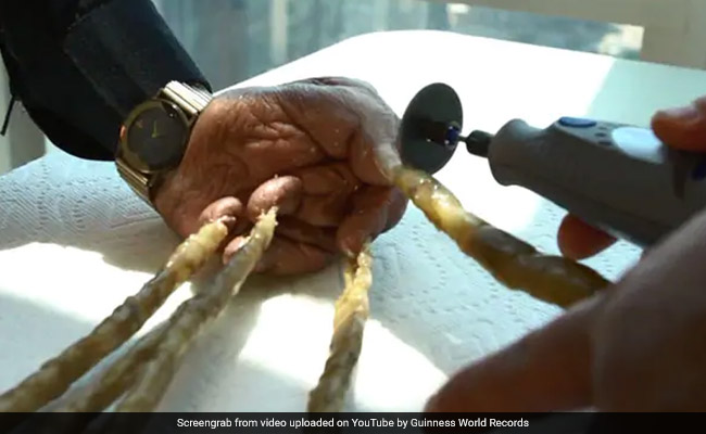 66 साल बाद जब इस शख्स ने काटे नाखून तो देखें क्या हुआ, Video हुआ वायरल