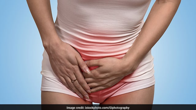 Painful urination can be caused because of kidney stones