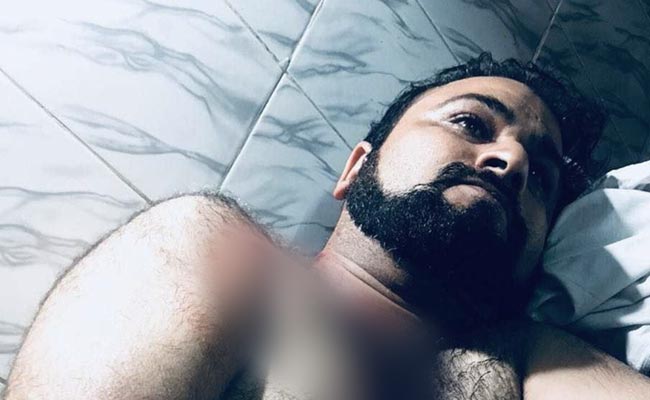 डॉ.कफील खान के भाई पर बाइक सवार बदमाशों ने किया जानलेवा हमला, हालत स्थिर