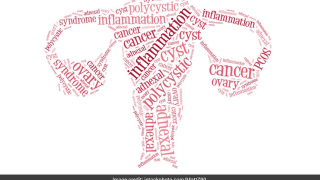 Polycystic Ovary Syndrome (PCOS) can cause difficulty in getting pregnant