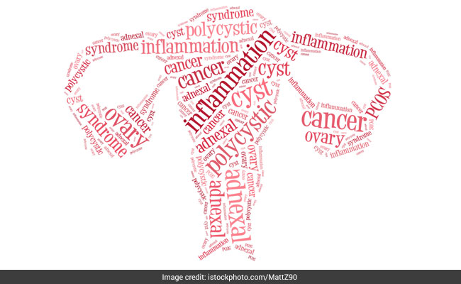 Polycystic Ovary Syndrome (PCOS) can cause difficulty in getting pregnant