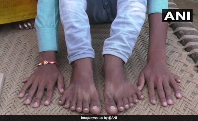 यूपी: हाथ और पैर में 12-12 उंगलियां, रिश्तेदार बने जान के दुश्मन, जानें क्या है पूरा मामला