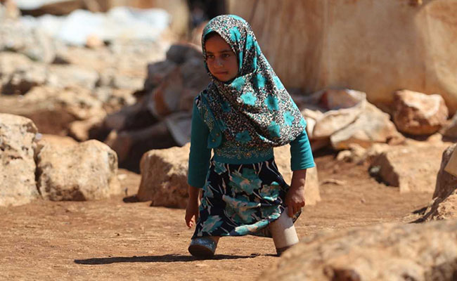 Syrian Girl, 8, Born With No Legs, Finds Hope In Turkey