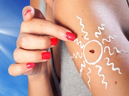Melanoma: Causes, Symptoms And Prevention Melanoma: Causes, Symptoms And Prevention