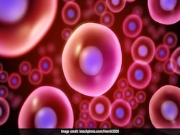 World Sickle Cell Day 2019: Do You Know What Causes Sickle Cell Anaemia? Find Out Here World Sickle Cell Day 2019: Do You Know What Causes Sickle Cell Anaemia? Find Out Here